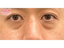 今月のベスト症例写真