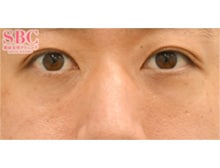 今月のベスト症例写真