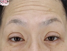 今月のベスト症例写真