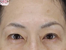 今月のベスト症例写真