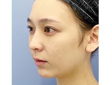 今月のベスト症例写真