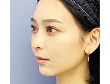 今月のベスト症例写真