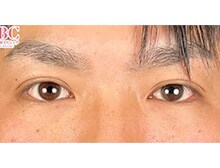 今月のベスト症例写真