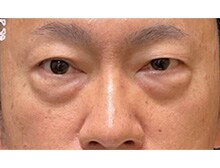 今月のベスト症例写真