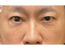 今月のベスト症例写真
