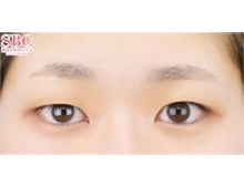 今月のベスト症例写真