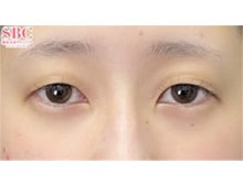今月のベスト症例写真