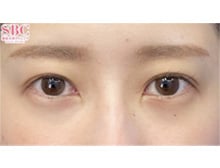 今月のベスト症例写真