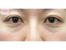 今月のベスト症例写真