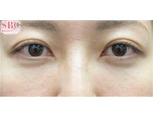 今月のベスト症例写真