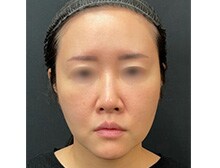 今月のベスト症例写真