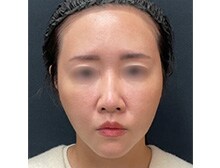 今月のベスト症例写真