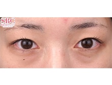 今月のベスト症例写真