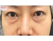 今月のベスト症例写真