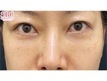 今月のベスト症例写真