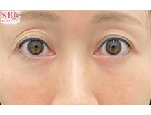 今月のベスト症例写真