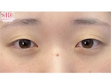 今月のベスト症例写真