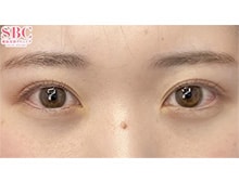今月のベスト症例写真
