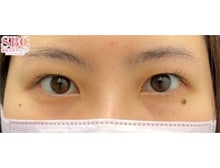 今月のベスト症例写真