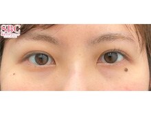 今月のベスト症例写真