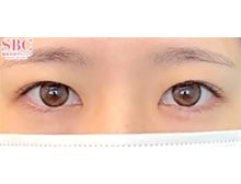 今月のベスト症例写真