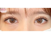今月のベスト症例写真