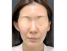 今月のベスト症例写真