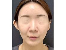 今月のベスト症例写真