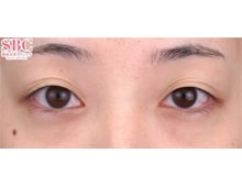 今月のベスト症例写真