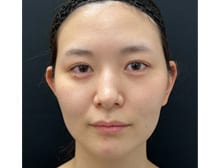 今月のベスト症例写真