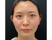 今月のベスト症例写真