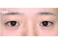 今月のベスト症例写真