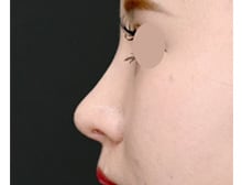 今月のベスト症例写真