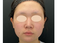 今月のベスト症例写真