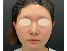 今月のベスト症例写真