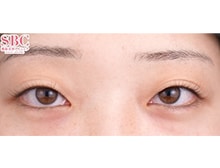 今月のベスト症例写真