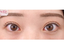 今月のベスト症例写真
