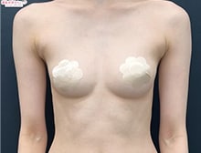 今月のベスト症例写真