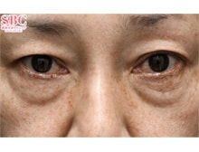 今月のベスト症例写真