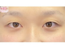 今月のベスト症例写真