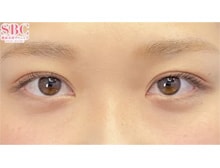 今月のベスト症例写真