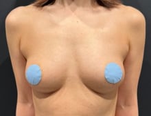 今月のベスト症例写真