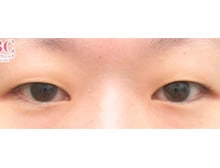 今月のベスト症例写真