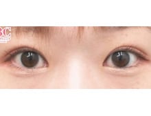 今月のベスト症例写真