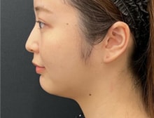 今月のベスト症例写真