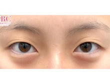 今月のベスト症例写真