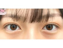 今月のベスト症例写真