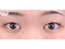 今月のベスト症例写真