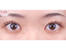 今月のベスト症例写真