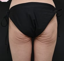 症例写真